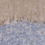 FABP7 Antibody in Immunohistochemistry (Paraffin) (IHC (P))