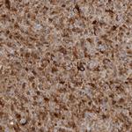 FABP7 Antibody in Immunohistochemistry (Paraffin) (IHC (P))