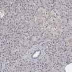 MOGAT2 Antibody in Immunohistochemistry (Paraffin) (IHC (P))