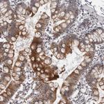 MOGAT2 Antibody in Immunohistochemistry (Paraffin) (IHC (P))