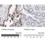 AP2 alpha Antibody