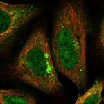 AP2 alpha Antibody in Immunocytochemistry (ICC/IF)