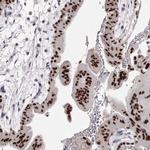 AP2 alpha Antibody in Immunohistochemistry (Paraffin) (IHC (P))