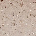 HIP2 Antibody in Immunohistochemistry (Paraffin) (IHC (P))