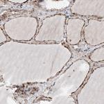 PPAP2B Antibody in Immunohistochemistry (Paraffin) (IHC (P))