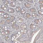 BHLHE40 Antibody in Immunohistochemistry (Paraffin) (IHC (P))