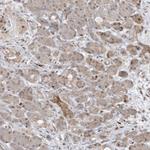 BHLHE40 Antibody in Immunohistochemistry (Paraffin) (IHC (P))