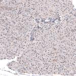 SMYD2 Antibody in Immunohistochemistry (Paraffin) (IHC (P))