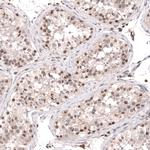 SMYD2 Antibody in Immunohistochemistry (Paraffin) (IHC (P))