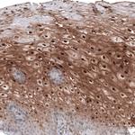 SMYD2 Antibody in Immunohistochemistry (Paraffin) (IHC (P))