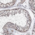 PPP2R5D Antibody in Immunohistochemistry (Paraffin) (IHC (P))