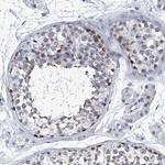 PPP2R5D Antibody in Immunohistochemistry (Paraffin) (IHC (P))