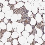 FBXO5 Antibody in Immunohistochemistry (Paraffin) (IHC (P))