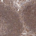 FBXO5 Antibody in Immunohistochemistry (Paraffin) (IHC (P))