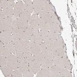 FBXO5 Antibody in Immunohistochemistry (Paraffin) (IHC (P))