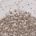 eIF5A2 Antibody in Immunohistochemistry (Paraffin) (IHC (P))