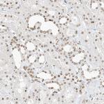 eIF5A2 Antibody in Immunohistochemistry (Paraffin) (IHC (P))