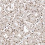 eIF5A2 Antibody in Immunohistochemistry (Paraffin) (IHC (P))