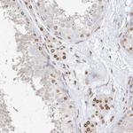 eIF5A2 Antibody in Immunohistochemistry (Paraffin) (IHC (P))