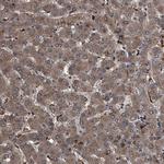 MAPKAP1 Antibody in Immunohistochemistry (Paraffin) (IHC (P))