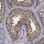 MAPKAP1 Antibody in Immunohistochemistry (Paraffin) (IHC (P))