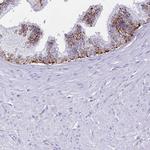 LYAG Antibody in Immunohistochemistry (Paraffin) (IHC (P))