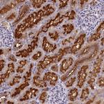 V-ATPase E1 Antibody in Immunohistochemistry (Paraffin) (IHC (P))