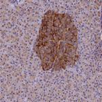 V-ATPase E1 Antibody in Immunohistochemistry (Paraffin) (IHC (P))