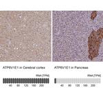 V-ATPase E1 Antibody