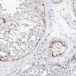 NHP2L1 Antibody in Immunohistochemistry (Paraffin) (IHC (P))