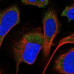 PPM1A Antibody in Immunocytochemistry (ICC/IF)