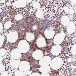 PPM1A Antibody in Immunohistochemistry (Paraffin) (IHC (P))