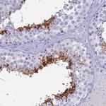 ACE Antibody in Immunohistochemistry (Paraffin) (IHC (P))