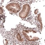 HOXA5 Antibody in Immunohistochemistry (Paraffin) (IHC (P))