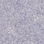 COL6A1 Antibody in Immunohistochemistry (Paraffin) (IHC (P))