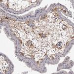 COL6A1 Antibody in Immunohistochemistry (Paraffin) (IHC (P))