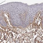 COL6A1 Antibody in Immunohistochemistry (Paraffin) (IHC (P))