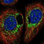 DAP Antibody in Immunocytochemistry (ICC/IF)