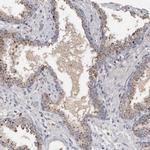 DAP Antibody in Immunohistochemistry (Paraffin) (IHC (P))