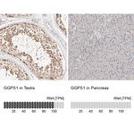 GGPS1 Antibody