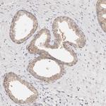 GGPS1 Antibody in Immunohistochemistry (Paraffin) (IHC (P))