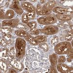 APEH Antibody in Immunohistochemistry (Paraffin) (IHC (P))