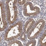 APEH Antibody in Immunohistochemistry (Paraffin) (IHC (P))