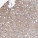 APEH Antibody in Immunohistochemistry (Paraffin) (IHC (P))