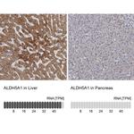 ALDH5A1 Antibody