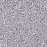 ALDH5A1 Antibody in Immunohistochemistry (Paraffin) (IHC (P))