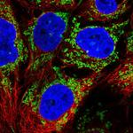 ALDH5A1 Antibody in Immunocytochemistry (ICC/IF)