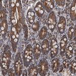 ALDH5A1 Antibody in Immunohistochemistry (Paraffin) (IHC (P))