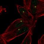 E2F1 Antibody in Immunocytochemistry (ICC/IF)