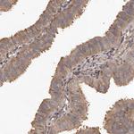 SLC22A3 Antibody in Immunohistochemistry (Paraffin) (IHC (P))